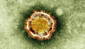 198863_coronavirus_663_382