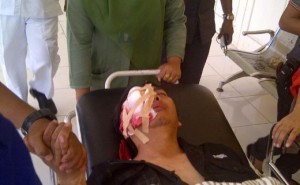 Anton Nugroho, wartawan Trans7 yang tertembak saat meliput aksi demo menentang kenaikan harga BBM di Jambi.