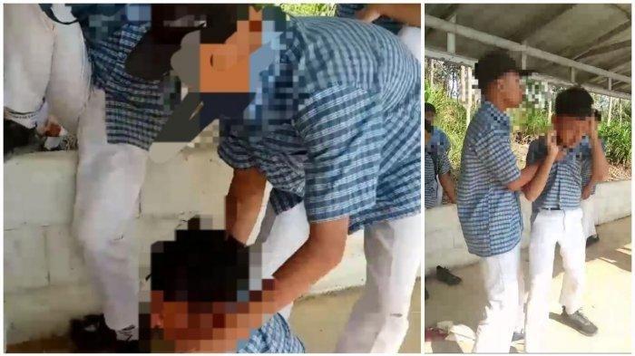 Kondisi FF, Siswa SMP Korban Perundungan Di Cilacap, Alami Patah Tulang Rusuk Hingga Dada Sesak